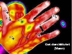 gut durchblutete Hand eines Mannes