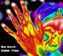 gut durchblutete Hand einer Frau