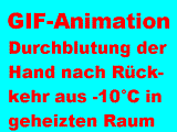 Durchblutung der Hand nach R�ckkehr aus -10�C in geheizten Raum